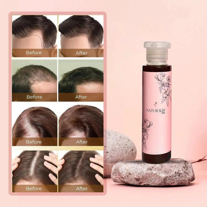 Natural Hair Oil - 100ml